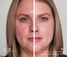Afbeelding in Gallery-weergave laden, HydroPure Color Corrective Serum