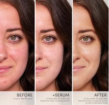 Afbeelding in Gallery-weergave laden, HydroPure Color Corrective Serum