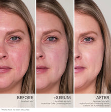 Afbeelding in Gallery-weergave laden, HydroPure Color Corrective Serum
