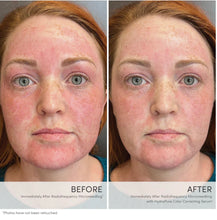 Afbeelding in Gallery-weergave laden, HydroPure Color Corrective Serum