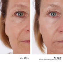 Afbeelding in Gallery-weergave laden, BeautyPrep™ Hyaluronic Serum